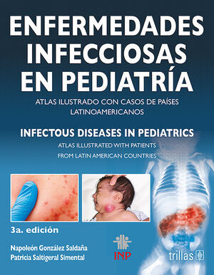 ENFERMEDADES INFECCIOSAS EN PEDIATRIA = INFECTOUS DISEASES IN PEDIATRICS | GONZALEZ SALDAÑA, NAPOLEON; SALTIGERAL SIMENTAL, PATRICIA | Trillas