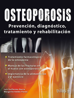Osteoporosis | IBARRA, LUIS GUILLERMO; VALDES FLORES, MARGARITA | Trillas