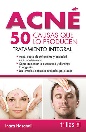 Acné 50 causas que lo producen | HASANALI, INARA | Trillas