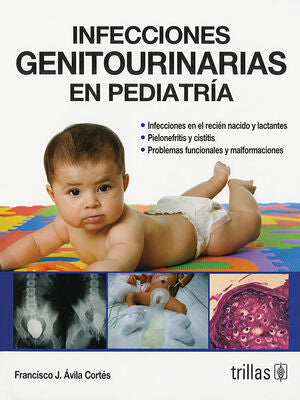 INFECCIONES GENITOURINARIAS EN PEDIATRIA | AVILA CORTES, FRANCISCO JAVIER | Trillas