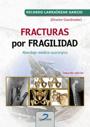 Fracturas Por Fragilidad. Abordaje Médico-quirúrgico