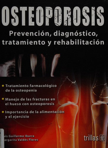 Osteoporosis Prevencion Diagnostico Tratamiento Rehabilita [Paperback] Luis Guillermo Ibarra and TRILLAS, EDITORIAL