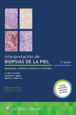 Interpretación de biopsia de la piel: Neoplasias cutáneas primarias no linfoides [Paperback] Crowson MD, A. Neil; Magro MD, Cynthia M. and Mihm Jr.  MD, Martin C.