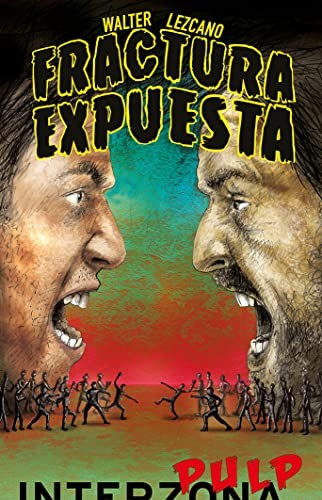 Fractura Expuesta LEZCANO, WALTER ISAAC